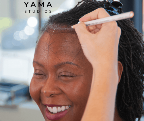 Scalp micropigmentation is the fastest and easiest way to rebuild your hairline in Honolulu, Hawaii at YAMA Studios.